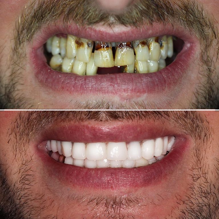 Pro Dental Clinic Harley Street Dental Clinic