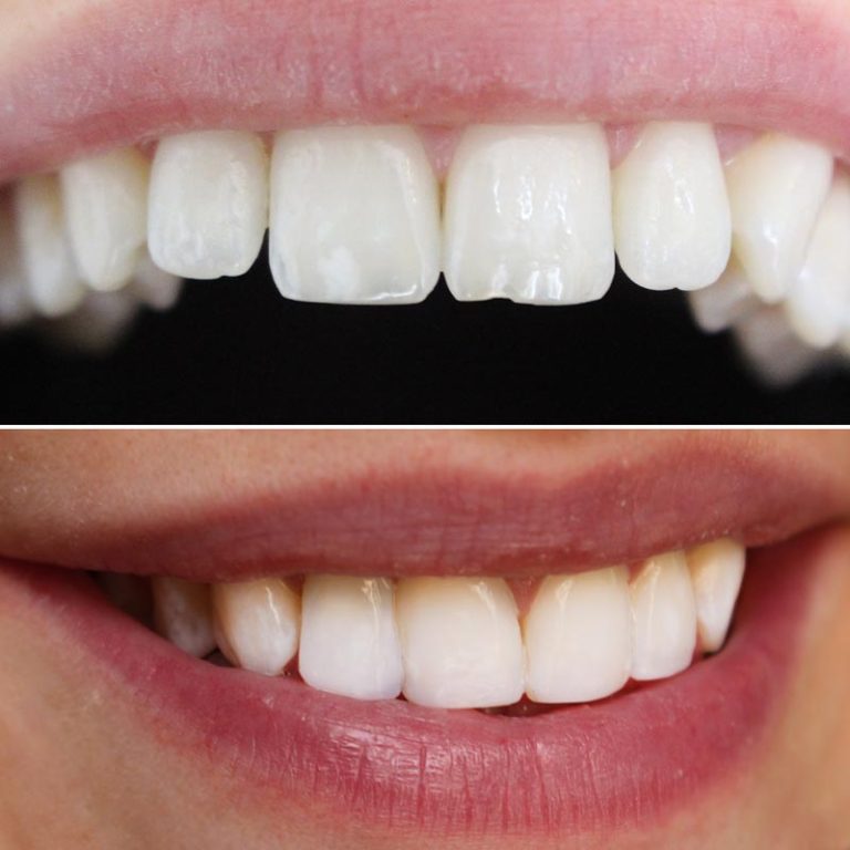 Cosmetic Treatments Pro Dental Clinic Harley Street Dentist